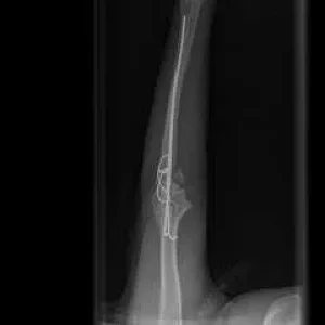 k-direkt nach op.jpg