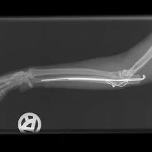 k-nach 10 wochen.jpg